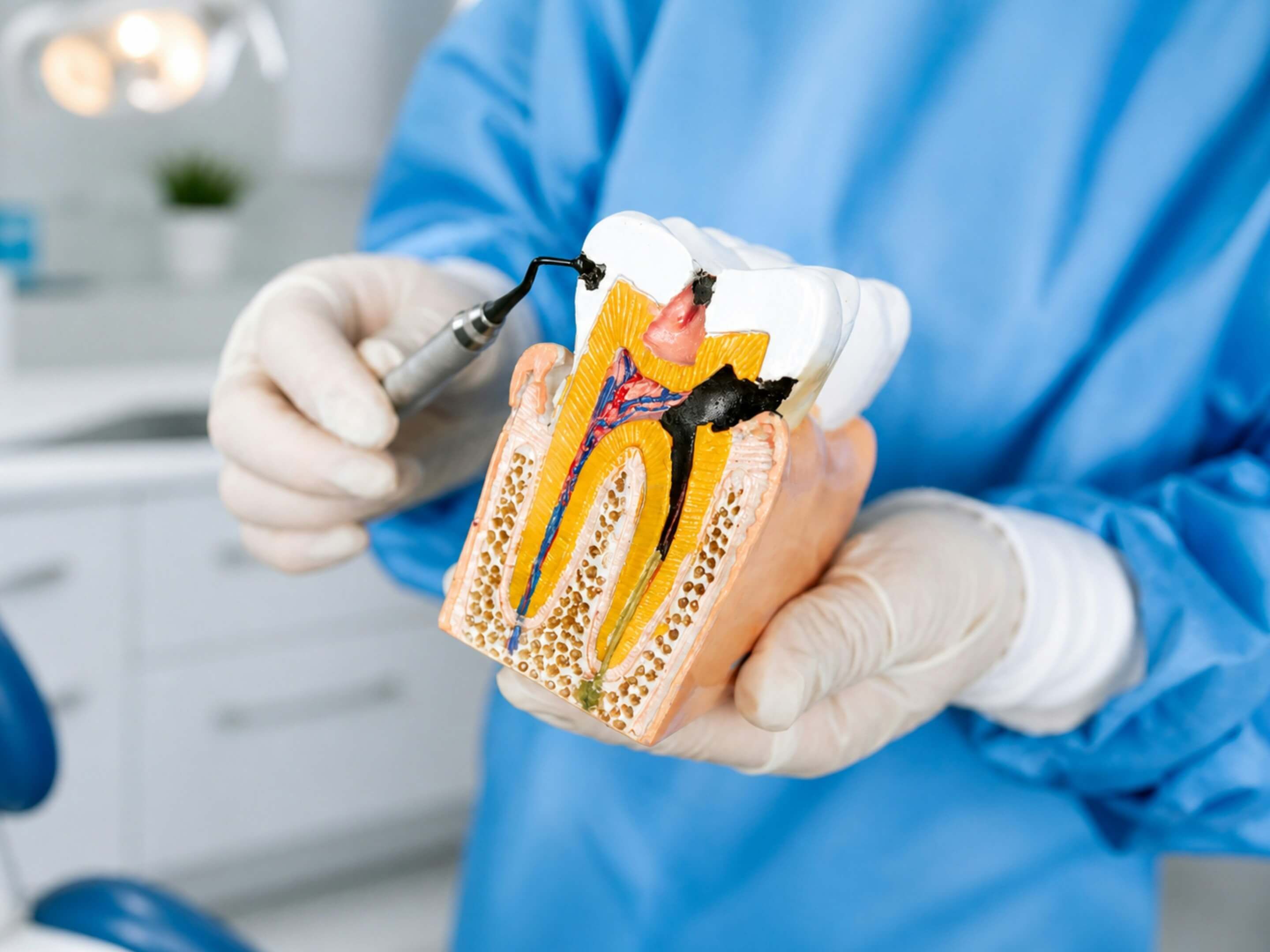 A dental professional demonstrating root canal treatment on a tooth model